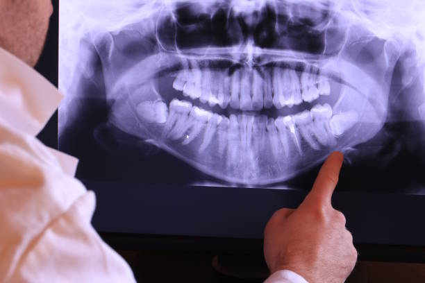 Best Emergency Broken Tooth Repair in Gerdine, AL